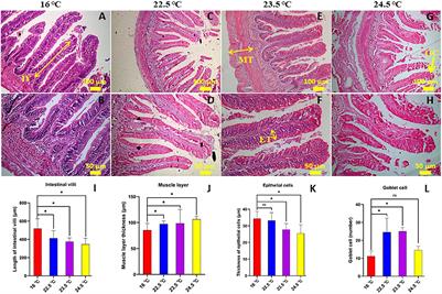 Association of Gut Microbiota With Metabolism in Rainbow Trout Under Acute Heat Stress